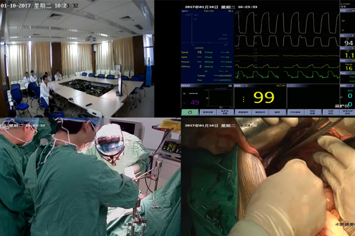 亿维医疗数字化手术室系统成功应用于安顺市妇幼保健院